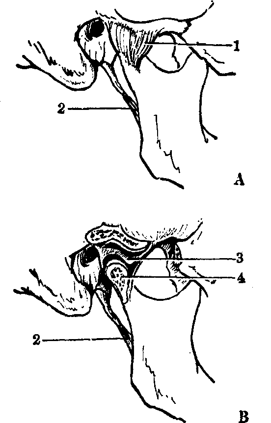 顳下頜關(guān)節(jié)