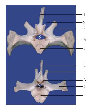 圖1-28 薦椎后面觀