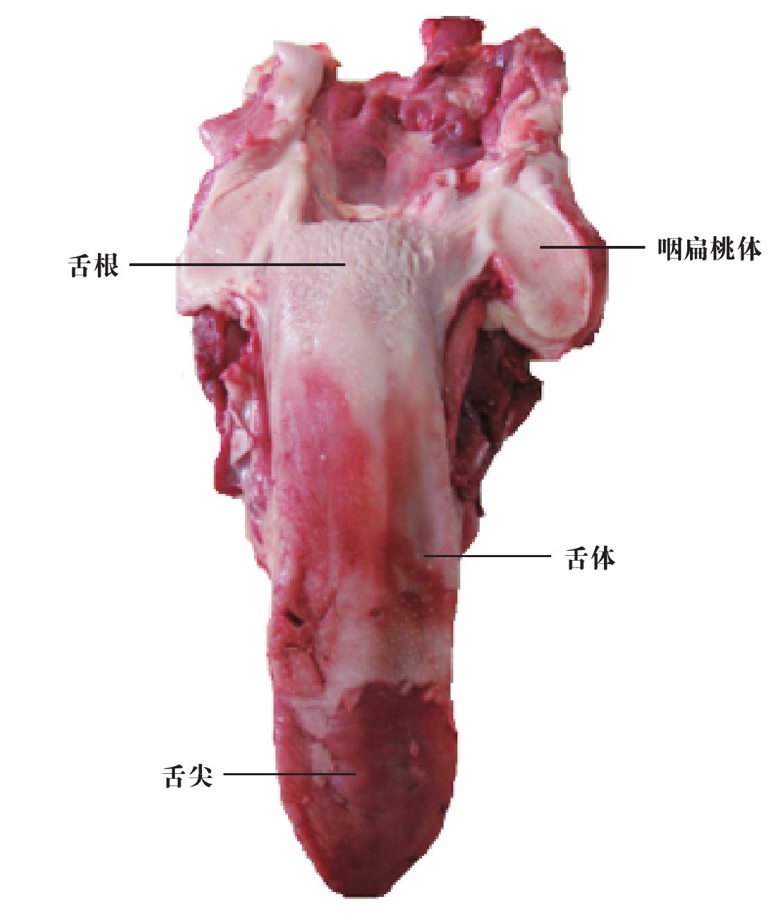 三、扁桃體